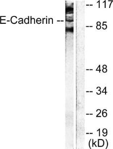 Western blot analysis of lysates from NIH/3T3 cells using Anti-Cadherin-pan Antibody. The right hand lane represents a negative control, where the Antibody is blocked by the immunising peptide