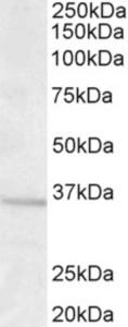 EB07187 (1.0 µg/ml) staining of Human Brain (Frontal Cortex) lysate (35 µg protein in RIPA buffer). Primary incubation was 1 hour. Detected by chemiluminescence.