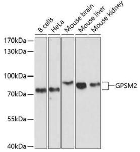 Anti-LGN Rabbit Polyclonal Antibody