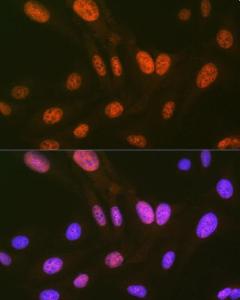 Anti-HIPK2 Rabbit Monoclonal Antibody [clone: ARC1631]