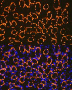 Immunofluorescence analysis of mouse kidney cells using Anti-Cadherin 16 Antibody [ARC2212] (A305939) at a dilution of 1:100 (40x lens). DAPI was used to stain the cell nuclei (blue)