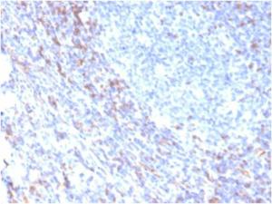 Immunohistochemical analysis of formalin-fixed, paraffin-embedded human tonsil using Anti-ZAP70 Antibody [rZAP70/2046]