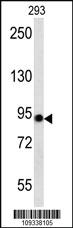 Anti-ACO2 Rabbit Polyclonal Antibody