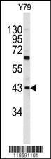 Anti-PRELP Rabbit Polyclonal Antibody