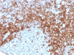 Antibody anti-CD5 RC56429 100 µg