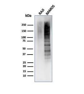 Western blot analysis of Raji and Ramos cell lysates using Anti-Ki67 Antibody [MKI67/4945R]