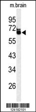 Anti-LRRTM1 Rabbit Polyclonal Antibody