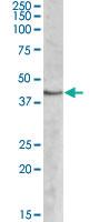 Anti-SPHK1 Goat Polyclonal Antibody