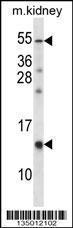 Anti-RAMP3 Rabbit Polyclonal Antibody (FITC (Fluorescein Isothiocyanate))