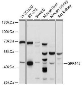 Western blot analysis of extracts of various cell lines, using Anti-GPR143 Antibody (A11333) at 1:1000 dilution