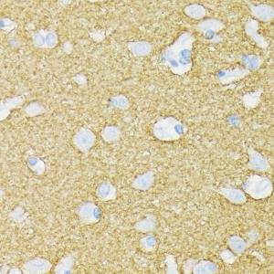 Immunohistochemistry analysis of paraffin-embedded human brain tissue using Anti-Munc18-1 Antibody [ARC1518] (A308829) at a dilution of 1:100 (40x lens)