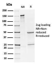 SDS-PAGE analysis of Anti-CD79a Antibody [HM57] under non-reduced and reduced conditions; showing intact IgG and intact heavy and light chains, respectively. SDS-PAGE analysis confirms the integrity and purity of the antibody