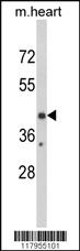 Anti-EGR3 Rabbit Polyclonal Antibody