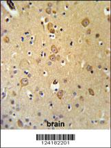 Anti-LRRTM1 Rabbit Polyclonal Antibody