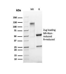 SDS-PAGE analysis of Anti-Ki67 Antibody [MKI67/4945R] under non-reduced and reduced conditions; showing intact IgG and intact heavy and light chains, respectively. SDS-PAGE analysis confirms the integrity and purity of the Antibody