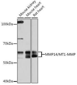 Anti-MMP14 Rabbit Monoclonal Antibody [clone: ARC0211]