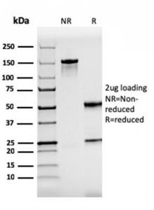 SDS-PAGE analysis of Anti-ZAP70 Antibody [rZAP70/2046] under non-reduced and reduced conditions; showing intact IgG and intact heavy and light chains, respectively. SDS-PAGE analysis confirms the integrity and purity of the antibody