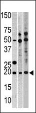 Anti-RPL23A Rabbit Polyclonal Antibody