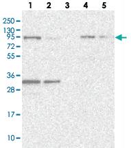 Anti-FCHO2 Rabbit Polyclonal Antibody