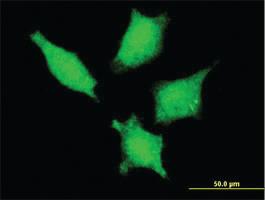 Anti-DDX20 Mouse Monoclonal Antibody [clone: 5H5]