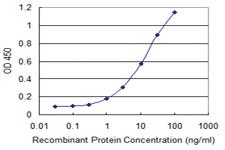 Anti-THRSP Mouse Monoclonal Antibody [clone: 2F8]