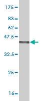 Anti-FGF1 Mouse Monoclonal Antibody [clone: 2E12]