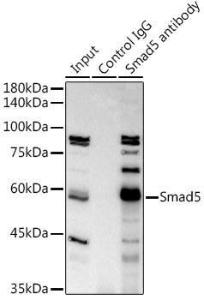 Immunoprecipitation analysis of 300 µg extracts of K-562 cells using 3 µg of Anti-SMAD5 Antibody [ARC0448] (A308830). This Western blot was performed on the immunoprecipitate using Anti-SMAD5 Antibody [ARC0448] (A308830) at a dilution of 1:1000