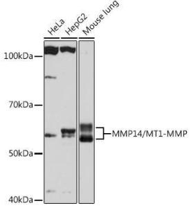 Anti-MMP14 Rabbit Monoclonal Antibody [clone: ARC0211]