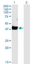 Anti-CD55 Mouse Monoclonal Antibody [clone: 1D7]