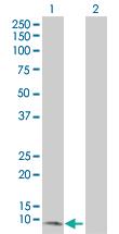 Anti-CXCL5 Mouse Polyclonal Antibody