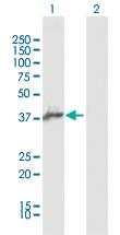 Anti-AIM2 Rabbit Polyclonal Antibody