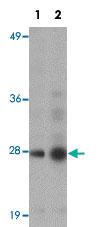 Anti-GEMIN2 Rabbit Polyclonal Antibody