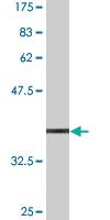 Anti-IKZF4 Mouse Monoclonal Antibody [clone: 4E6]