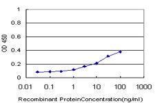 Anti-PIP4K2A Mouse Monoclonal Antibody [clone: 3A3]