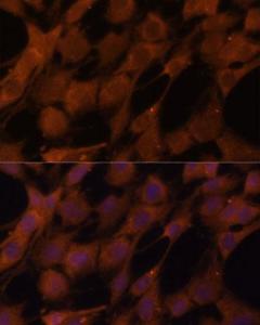 Immunofluorescence analysis of C6 cells using Anti-Legumain Antibody (A11334) at a dilution of 1:100 (40X lens). DAPI was used to stain the cell nuclei (blue)