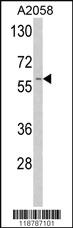 Anti-RNASE8 Rabbit Polyclonal Antibody