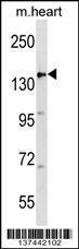 Anti-APC Rabbit Polyclonal Antibody (FITC (Fluorescein Isothiocyanate))