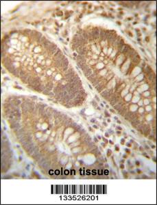 Anti-PGAM4 Rabbit Polyclonal Antibody (FITC (Fluorescein Isothiocyanate))