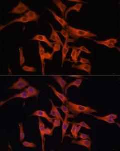 Immunofluorescence analysis of HeLa cells using Anti-Legumain Antibody (A11334) at a dilution of 1:100 (40X lens). DAPI was used to stain the cell nuclei (blue)