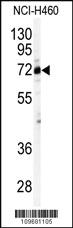 Anti-Cleavage stimulation factor 2 (CSTF2) Rabbit Polyclonal Antibody