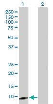 Anti-CXCL5 Mouse Polyclonal Antibody