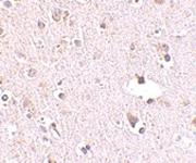 Anti-POLR3F Rabbit Polyclonal Antibody