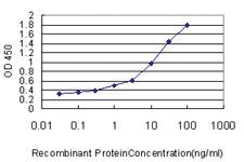 Anti-DDX20 Mouse Monoclonal Antibody [clone: 5H5]