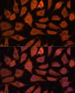 Immunofluorescence analysis of L929 cells using Anti-Legumain Antibody (A11334) at a dilution of 1:100 (40X lens). DAPI was used to stain the cell nuclei (blue)