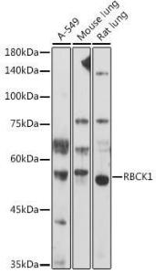 Anti-RBCK1 antibody