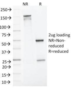 SDS-PAGE analysis of Anti-mlH1 Antibody [mlH1/1324] under non-reduced and reduced conditions; showing intact IgG and intact heavy and light chains, respectively. SDS-PAGE analysis confirms the integrity and purity of the antibody