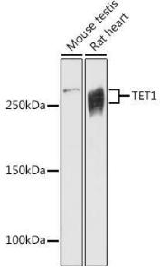 Western blot analysis of extracts of various cell lines, using Anti-TET1 Antibody (A305941) at 1:1,000 dilution. The secondary antibody was Goat Anti-Rabbit IgG H&L Antibody (HRP) at 1:10,000 dilution.