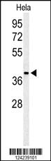 Anti-SIRT3 Rabbit Polyclonal Antibody