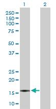 Anti-CXCL5 Rabbit Polyclonal Antibody