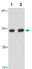 Anti-POLR3F Rabbit Polyclonal Antibody